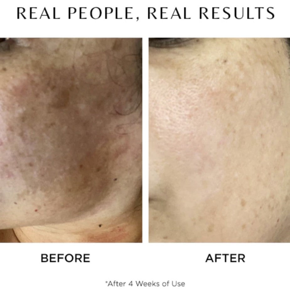 COSMEDIX REVERT SERUM VORHER NACHER ERGEBNISSE