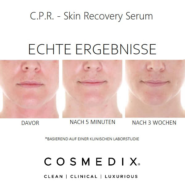 COSMEDIX-CPR-STUDIE-ERGEBNISSE-WIRKUNG