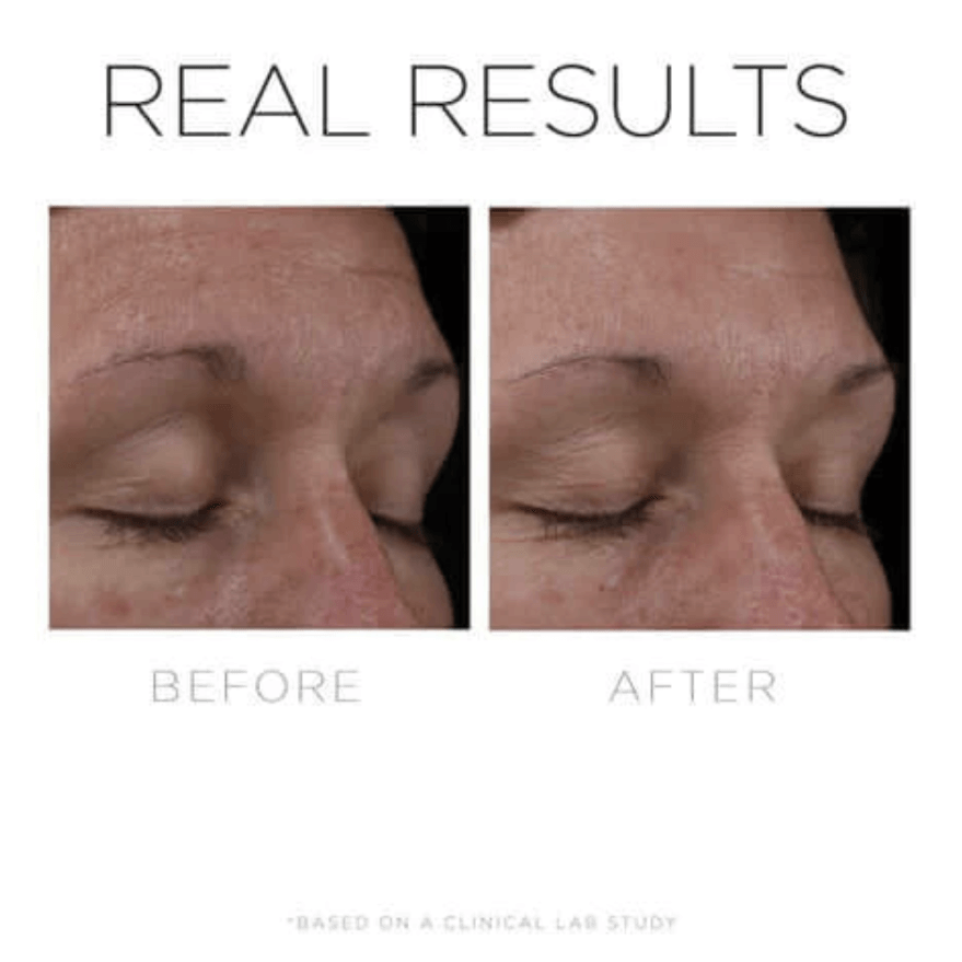 COSMEDIX SERUM 16 RETINOL VORHER NACHER